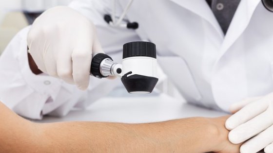 Melanoma, ecco le novità che allungano la vita